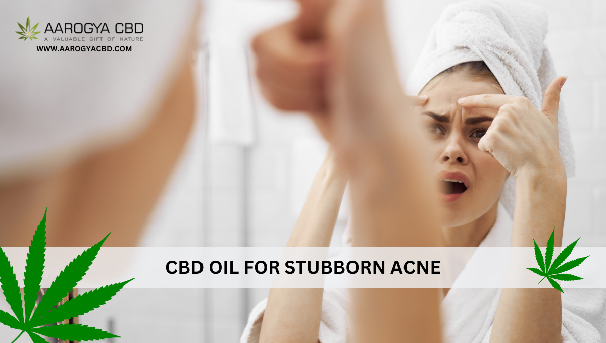 CBD Oil for Stubborn Acne